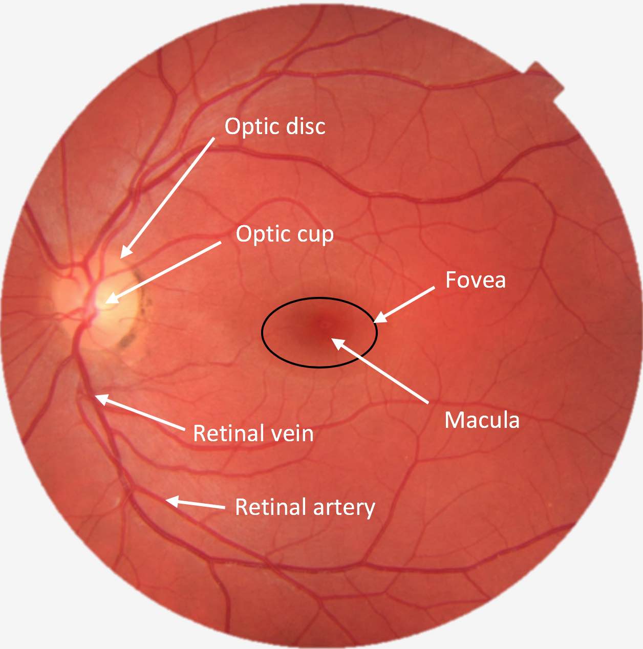 normal retina fundus photo normal retina fundus photo